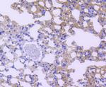 STAT6 Antibody in Immunohistochemistry (Paraffin) (IHC (P))