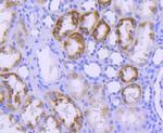 STAT6 Antibody in Immunohistochemistry (Paraffin) (IHC (P))