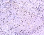 Phospho-JAK2 (Tyr1007, Tyr1008) Antibody in Immunohistochemistry (Paraffin) (IHC (P))