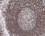 Phospho-JAK2 (Tyr1007, Tyr1008) Antibody in Immunohistochemistry (Paraffin) (IHC (P))