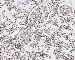 Phospho-JAK2 (Tyr1007, Tyr1008) Antibody in Immunohistochemistry (Paraffin) (IHC (P))