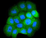 SMAD1 Antibody in Immunohistochemistry (Paraffin) (IHC (P))