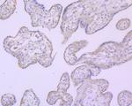 B-Raf Antibody in Immunohistochemistry (Paraffin) (IHC (P))