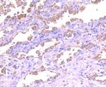 ASK1 Antibody in Immunohistochemistry (Paraffin) (IHC (P))