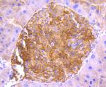 ASK1 Antibody in Immunohistochemistry (Paraffin) (IHC (P))