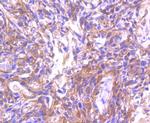 ASK1 Antibody in Immunohistochemistry (Paraffin) (IHC (P))