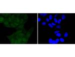 Phospho-IkB alpha (Ser32) Antibody in Immunocytochemistry (ICC/IF)