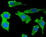 S100B Antibody in Immunocytochemistry (ICC/IF)