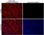 S100B Antibody in Immunohistochemistry (Paraffin) (IHC (P))