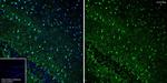 S100B Antibody in Immunohistochemistry (Paraffin) (IHC (P))