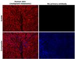 S100B Antibody in Immunohistochemistry (Paraffin) (IHC (P))