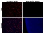 S100B Antibody in Immunohistochemistry (Paraffin) (IHC (P))