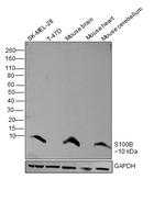 S100B Antibody in Western Blot (WB)