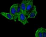 PYK2 Antibody in Immunocytochemistry (ICC/IF)