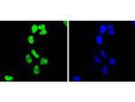 H2BK20ac Antibody in Immunocytochemistry (ICC/IF)