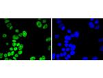 H2BK20ac Antibody in Immunocytochemistry (ICC/IF)