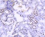 H2BK20ac Antibody in Immunohistochemistry (Paraffin) (IHC (P))