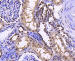 H2BK20ac Antibody in Immunohistochemistry (Paraffin) (IHC (P))