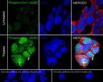 Phospho-Chk1 (Ser296) Antibody in Immunocytochemistry (ICC/IF)