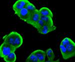 INSR beta Antibody in Immunocytochemistry (ICC/IF)