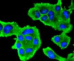 INSR beta Antibody in Immunocytochemistry (ICC/IF)