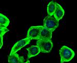 INSR beta Antibody in Immunocytochemistry (ICC/IF)