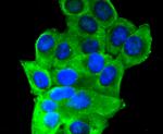 INSR beta Antibody in Immunocytochemistry (ICC/IF)