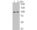 INSR beta Antibody in Western Blot (WB)