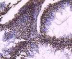 Histone H2B Antibody in Immunohistochemistry (Paraffin) (IHC (P))