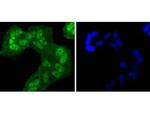 Phospho-EGFR (Tyr1068) Antibody in Immunocytochemistry (ICC/IF)