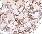 HDAC2 Antibody in Immunohistochemistry (Paraffin) (IHC (P))