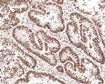 HDAC2 Antibody in Immunohistochemistry (Paraffin) (IHC (P))