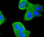 HDAC4 Antibody in Immunocytochemistry (ICC/IF)