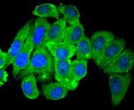 HDAC4 Antibody in Immunocytochemistry (ICC/IF)