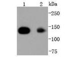 HDAC4 Antibody in Western Blot (WB)