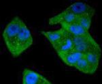 STAT5 beta Antibody in Immunocytochemistry (ICC/IF)