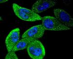 STAT5 beta Antibody in Immunocytochemistry (ICC/IF)