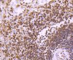 STAT5 beta Antibody in Immunohistochemistry (Paraffin) (IHC (P))