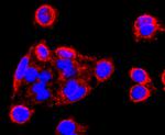 MMP13 Antibody in Immunocytochemistry (ICC/IF)