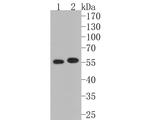 MMP13 Antibody in Western Blot (WB)