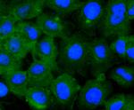 STAT2 Antibody in Immunocytochemistry (ICC/IF)