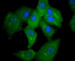 STAT2 Antibody in Immunocytochemistry (ICC/IF)