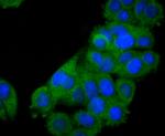 STAT2 Antibody in Immunocytochemistry (ICC/IF)