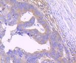 STAT2 Antibody in Immunohistochemistry (Paraffin) (IHC (P))