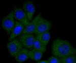 ApoA1 Antibody in Immunocytochemistry (ICC/IF)