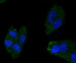 ApoA1 Antibody in Immunocytochemistry (ICC/IF)