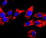 DRD1 Antibody in Immunocytochemistry (ICC/IF)