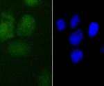 PDCD4 Antibody in Immunocytochemistry (ICC/IF)