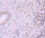 PDCD4 Antibody in Immunohistochemistry (Paraffin) (IHC (P))