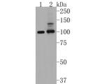 PSD93 Antibody in Western Blot (WB)